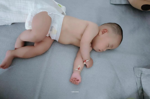 进贤六个月宝宝眼睛散光